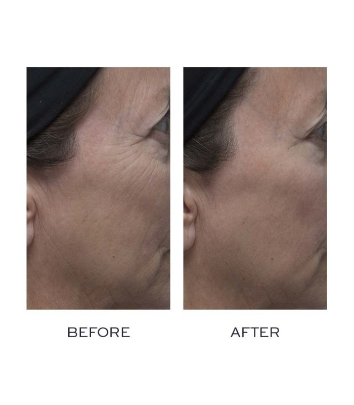 Elemis Vp Peptide4 Night Recovery CreaM-Oil 30ml - CEL50163